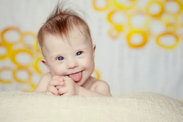 Cheerful little baby girl with Downs Syndrome — Stock Photo, Image