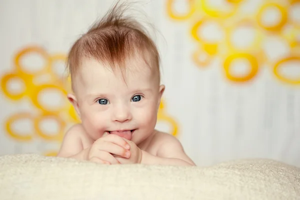 Bayi gadis kecil ceria dengan Downs Syndrome — Stok Foto