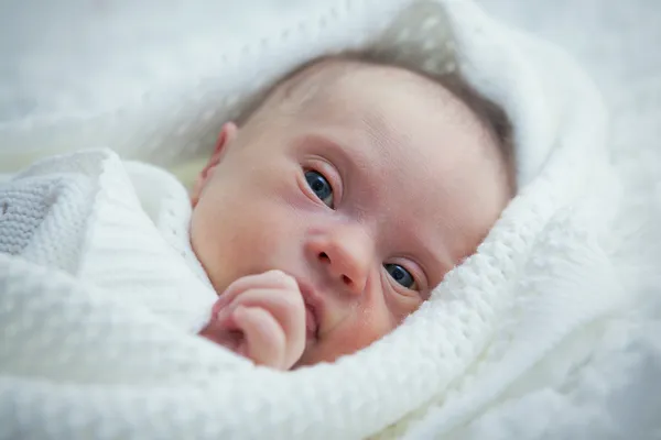 Newborn with Down syndrome is quiet and looks — Stock Photo, Image