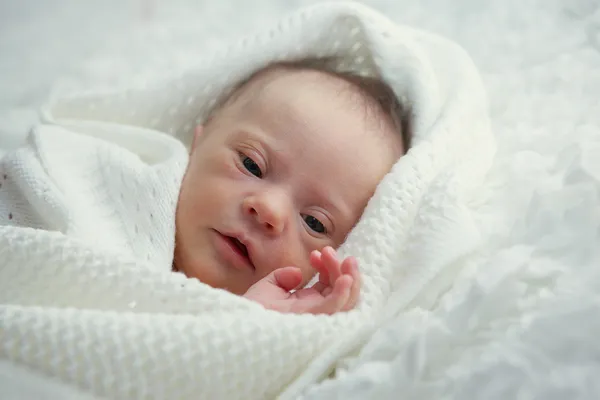 newborn with Down syndrome is quiet and looks