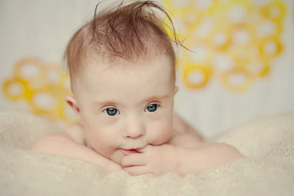 Fröhliches kleines Mädchen mit Down-Syndrom — Stockfoto