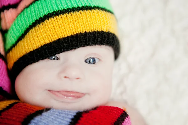 Little baby in hat gnome with Downs syndrome — Stock Photo, Image