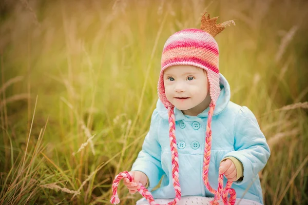 Bambino con sindrome di Down sembra sorpreso — Foto Stock