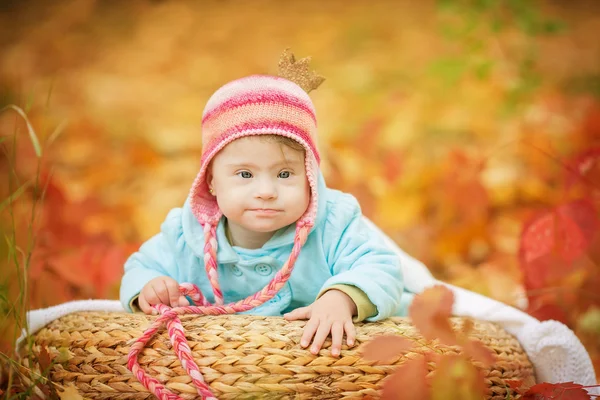 Baby with Down syndrome is resting in autumn forest — Stock Photo, Image