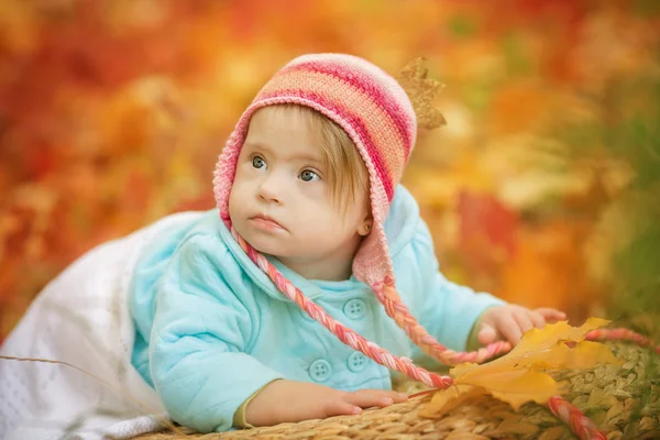 Baby with Down syndrome is resting in autumn forest — Stock Photo, Image