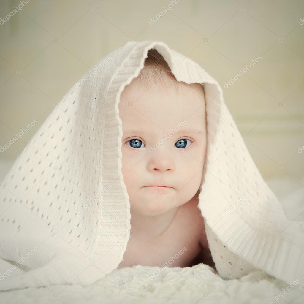 Small serious baby with Down syndrome hid under blanket — Stock Photo