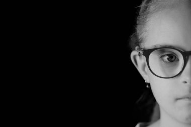 Down sendromlu bir kızın siyah beyaz portresi.