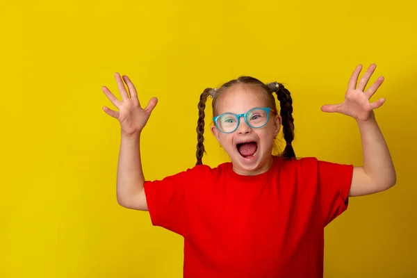 Chica feliz con síndrome de Down divertirse y reír en el estudio — Foto de Stock