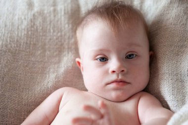 Down sendromlu pozitif bir kızın portresi..