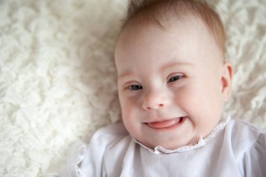 Down sendromlu pozitif bir kızın portresi..