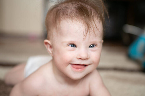 Портрет забавной девушки с синдромом Дауна