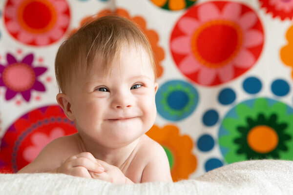 Портрет позитивной девушки с синдромом Дауна.