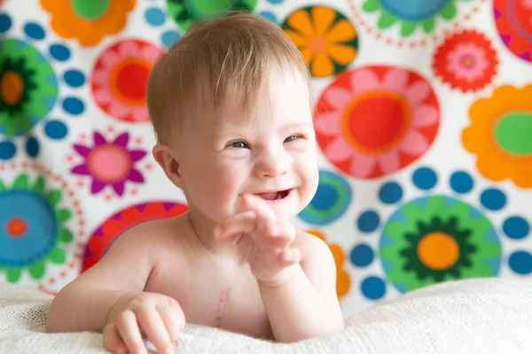 Portrait of a positive girl with Down syndrome. — Stock Photo, Image