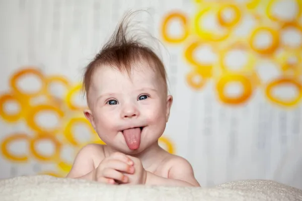 Portrait of a positive girl with Down syndrome. — Stock Photo, Image