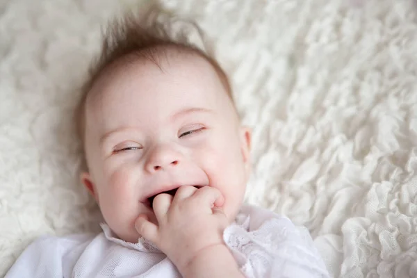 Portrait of a positive girl with Down syndrome. — Stock Photo, Image