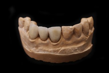 Diş Laboratuvarı prothetic. Teknik çekim.