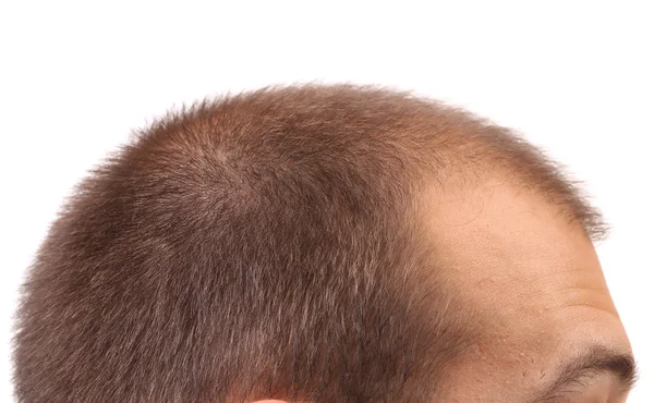 Mans head — Stock Photo, Image