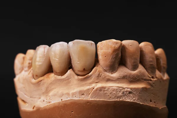 Impressão dentária . — Fotografia de Stock
