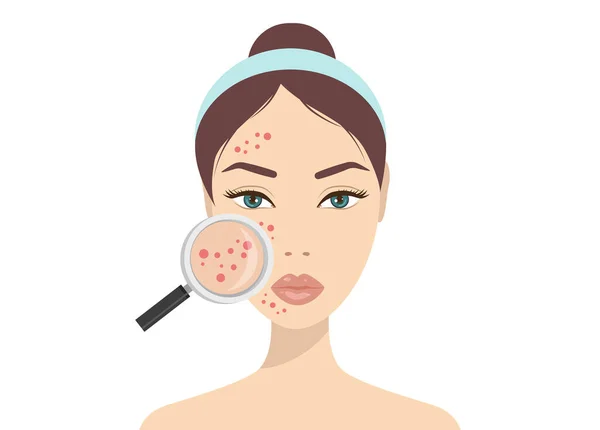 Acne Skin Problems Woman Holding Magnifying Glass Looking Cystic Acne — Stock Vector