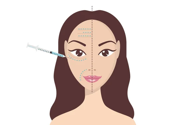 Injeção Facial Ácido Hialurônico Modelo Design Infográficos Vetoriais Beleza Cosmetologia —  Vetores de Stock