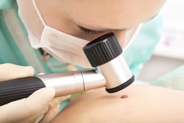 Mole checkup. — Stock Photo, Image