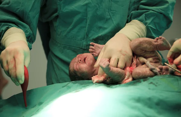 Pasgeboren baby in de kamer van arbeid — Stockfoto