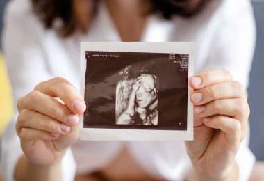 Hamile bir kadın ellerinde ceninin ultrason görüntüsünü taşıyor. Yakından bak. Hamilelik ve ebeveynlik kavramı.