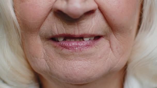 Close-up macro of toothless smile mouth of female senior woman dental problem, bad teeth loss — Stock Video