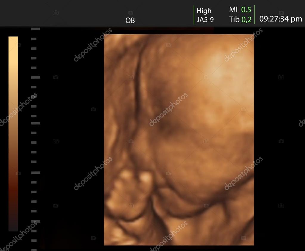 Image Of Newborn Baby Like 3d Ultrasound Of Baby In Mother S Womb Stock Photo By C Valentinar Image Of Newborn Baby Like 3d Ultrasound Of Baby In Mother S Womb Stock Photo By C Valentinar