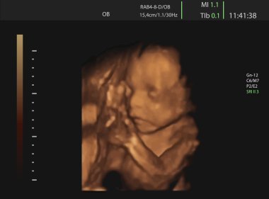 Download Ultrasound Baby Free Vector Eps Cdr Ai Svg Vector Illustration Graphic Art