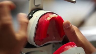 Diş Protez geliştirmek