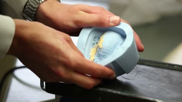 Dişçi dişlerini özel ekipman tarafından — Stok video