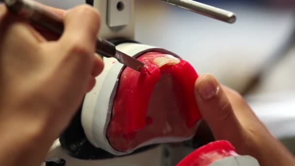 Розвивати зубних протезів — стокове відео