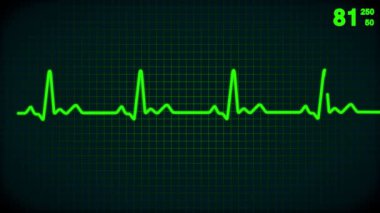 hareketli yaşam çizgisi