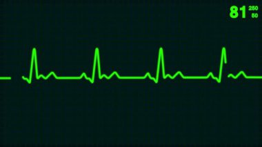 hareketli yaşam çizgisi