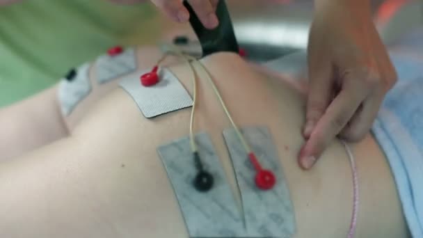 Verwijderen van de elektrotherapie zuignappen van klant — Stockvideo