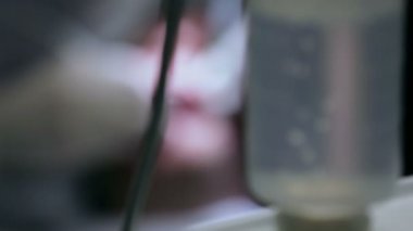 Diş hekimi ve istemci için diş aparatı odak vardiya