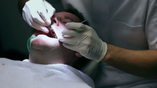 Tandläkaren kontrollerar kvaliteten på klientens tänder och möjliga karies — Stockvideo