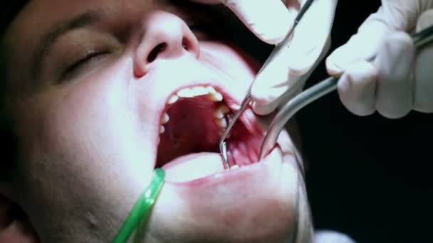 Dentist trying to fix clients teeth with his dental tools — Stock Video