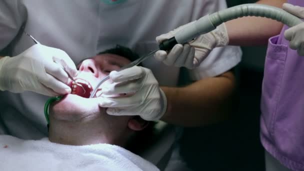 Dentista durante seu trabalho com a ajuda de assistente — Vídeo de Stock