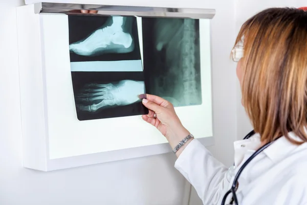 Vrouwelijke arts kijken naar patiënten x-ray — Stockfoto