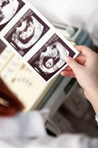 Médico mirando ultrasonido de bebé — Foto de Stock