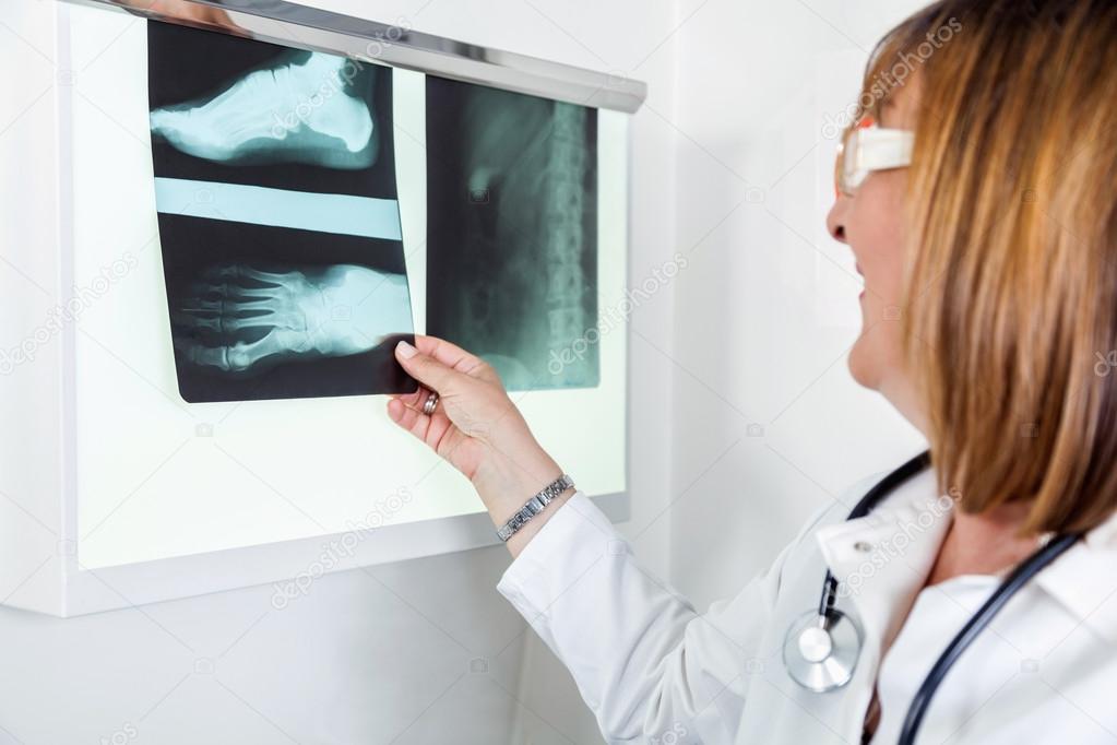 Female Doctor Looking At Patients X-ray