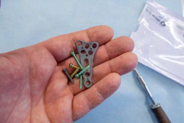 Açıklanan titanyum plaka ve ön kol kırığının çeşitli titanyum vidaları bir elde.