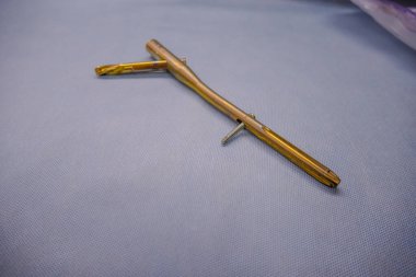 Açıklanan titanyum uyluk çivisi açık mavi bir destekle temizlenmiş.