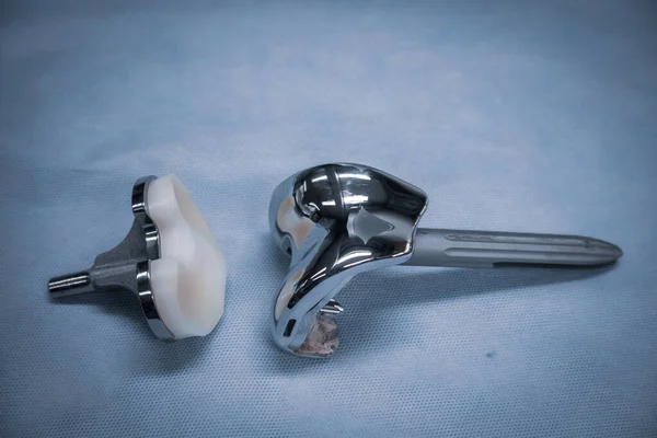 Complete Explanted Knee Prosthesis Consisting Distal Proximal Parts — Stock Fotó