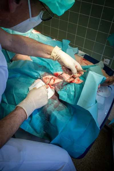 Hospital Doctor Stitches Wound Leg Patient — Foto Stock