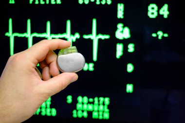 an implantable pacemaker is held in front of an ECG monitor  clipart
