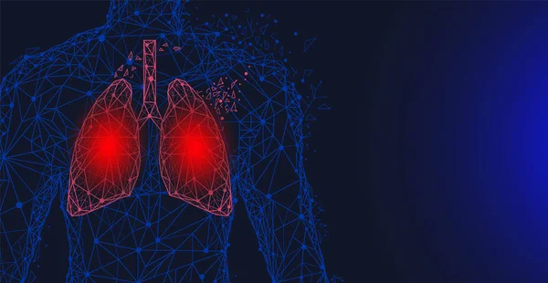 Acı dolu bölgeleri olan çokgen akciğerler. İnsan solunum sistemi organı. Bronşit, zatürree teşhisi