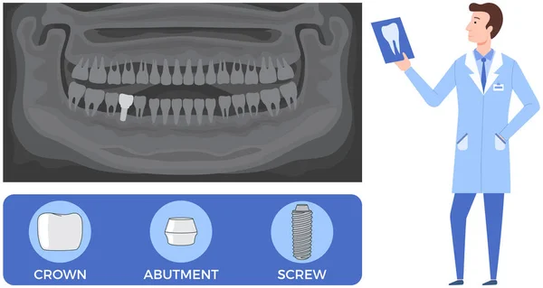 Orvos Fogprotézis Szerkezetéről Beszél Implantációs Fogászat Fogászat Fogápolás Kezelés Fogászati — Stock Vector